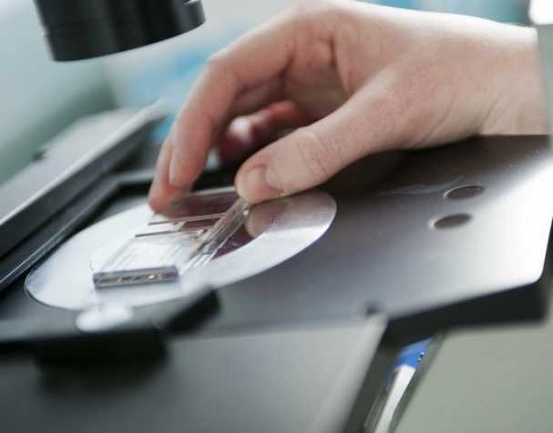 SAMe或成慢性結(jié)腸炎新希望? SAMe或成慢性結(jié)腸炎新希望?